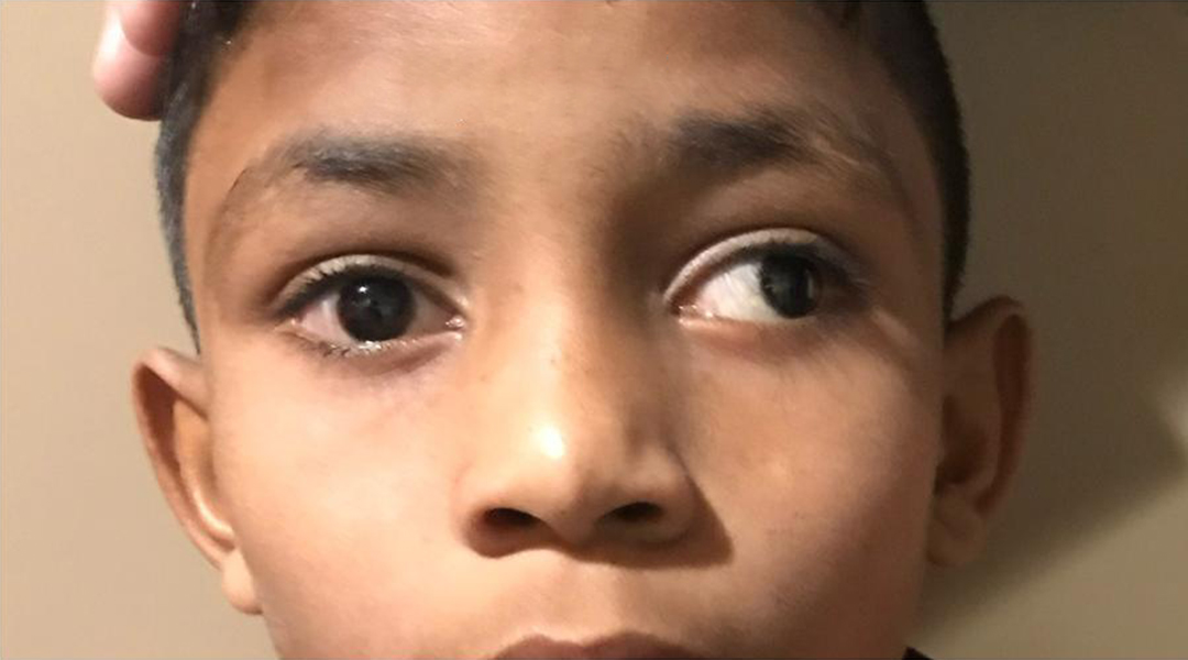 Eye and Oculoplasty Centre