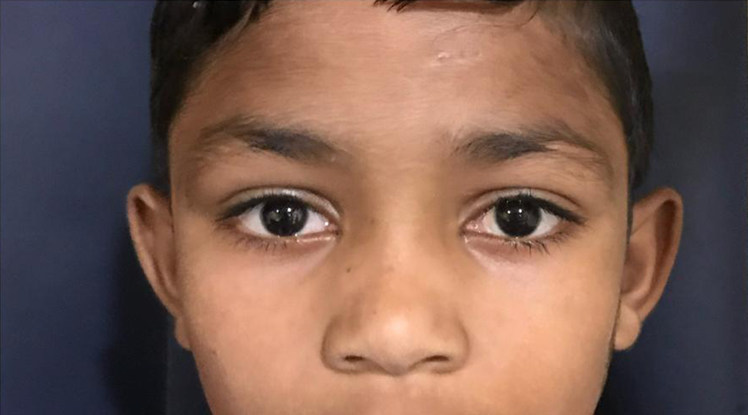 Eye and Oculoplasty Centre